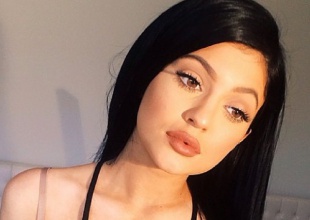 Se aumentó los labios